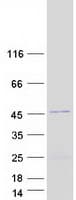 Human CCBL2 Protein (Recombinant Myc-DDK (Flag))
