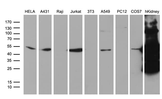 ASS1 / ASS Antibody (C-Terminus, clone OTI8H4)