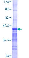 Human CASC5 Protein (Recombinant GST, N-terminus)