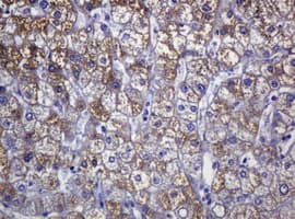 SOAT2 Antibody (clone OTI2D3)