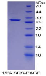 Human SOCS3 Protein (Recombinant 6His, N-terminus)