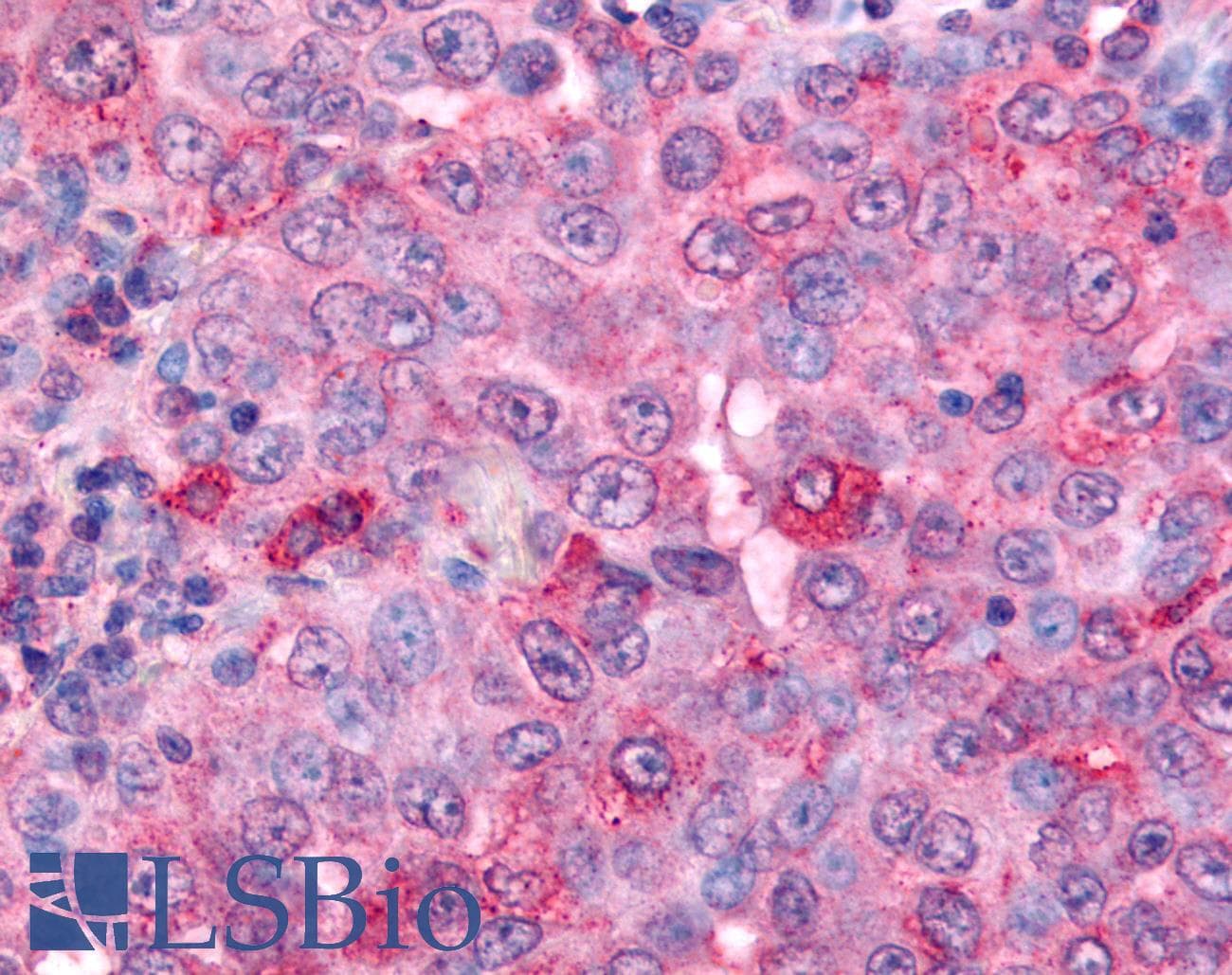 IHC-plus™ UCHL3 Antibody (C-Terminus)