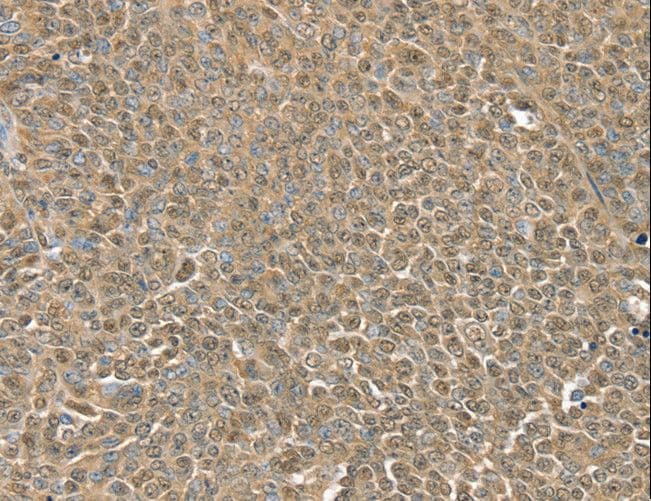 Polyclonal Rabbit anti-Human RNH1 Antibody (IHC, WB)