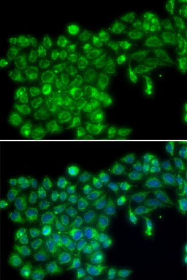 TNFSF13 / APRIL Antibody