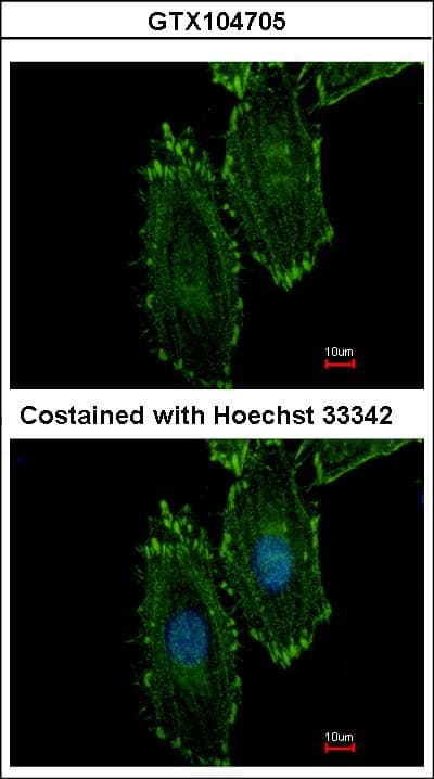 RASGRP4 Antibody (aa108-200)