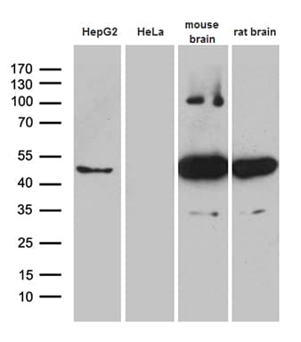Monoclonal Mouse anti-Human HOMER1 / Homer 1 Antibody (clone OTI7G10, Carrier-free, aa1-354, IHC, WB)