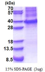 Human HOXB13 Protein (Recombinant His)