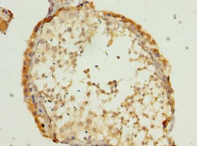 PORCN Antibody
