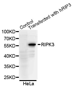 RIPK3 / RIP3 Antibody