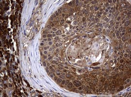 NME1 / NM23 Antibody (clone OTI22F10)