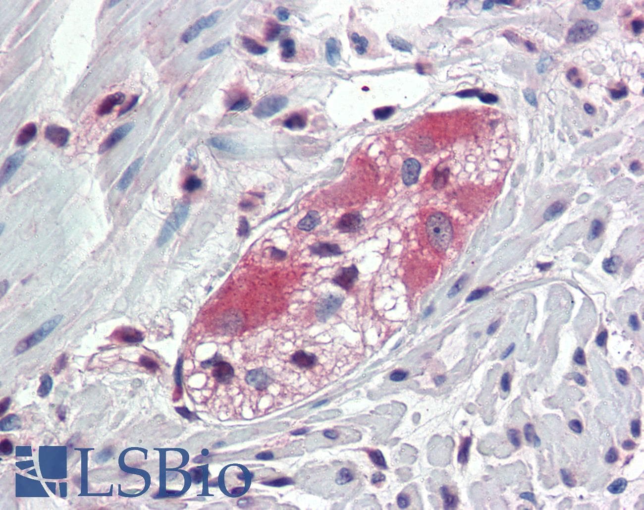 IHC-plus™ TXLNB Antibody (Internal)