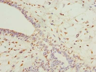 Polyclonal Rabbit anti-Human COLGALT2 / GLT25D2 Antibody (IHC, WB)