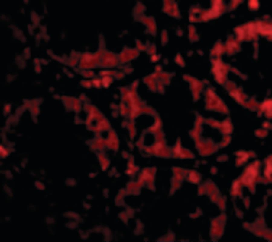 IHC-plus™ STEAP2 Antibody