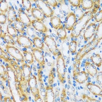 Polyclonal Rabbit anti-Human ARHGEF5 Antibody (IHC)