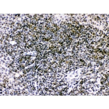 Polyclonal Rabbit anti-Human RAG2 / RAG-2 Antibody (aa498-527, IHC, WB)