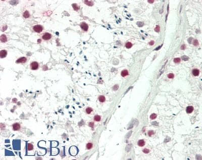 PDS5B / AS3 Antibody (aa1400-C-term)