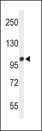 Polyclonal Rabbit anti-Human MICAL2 Antibody (aa55-83, WB)