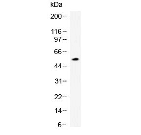 ANGPTL4 Antibody