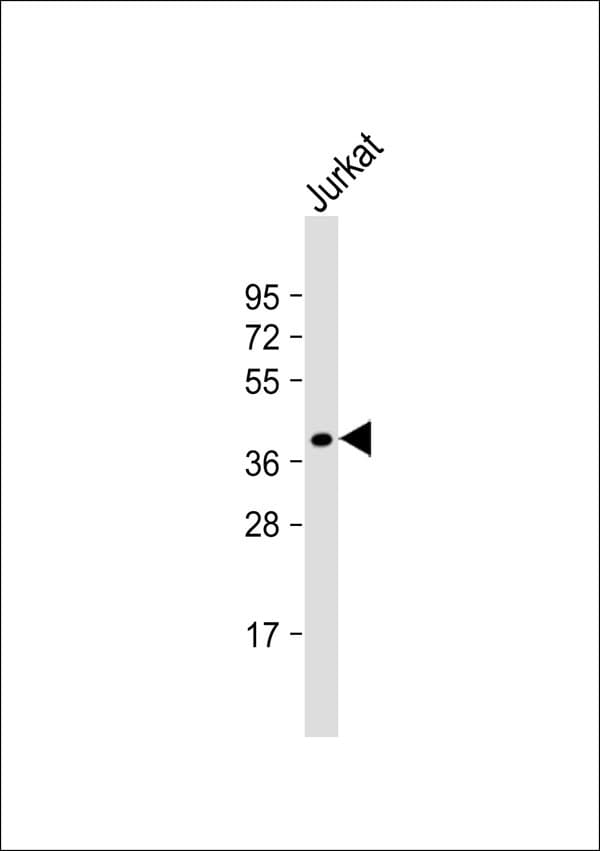 FAM84B Antibody