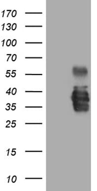 SSU72 Antibody (clone OTI4B3)
