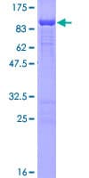 Human FAM65B / DIFF48 Protein (Recombinant GST)