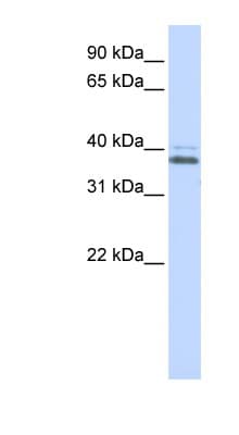 Polyclonal Rabbit anti-Human ERGIC2 Antibody (C-Terminus, WB)