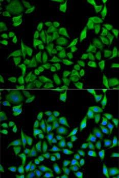 UGT1A / UGT1A1 Antibody