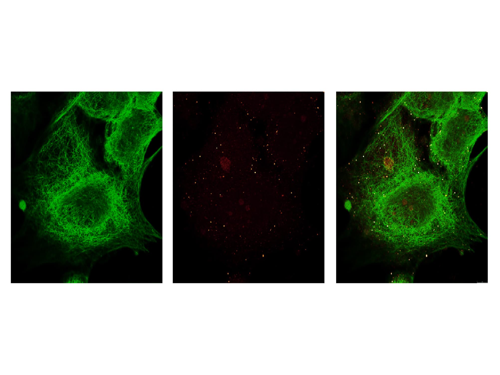 IHC-plus™ GLI3 Antibody