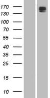PLB1 Protein (Over-Expression Lysate Myc-DDK (Flag))