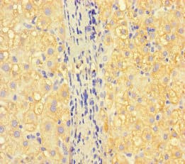 Polyclonal Rabbit anti-Human ISPD / Nip Antibody (IHC, IF)