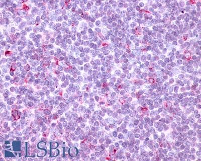 PathPlus™ Polyclonal Rabbit anti-Human CCR10 / GPR2 Antibody (C-Terminus, IHC)