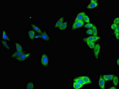 Polyclonal Rabbit anti-Human POU2F2 / OCT2 Antibody (IHC, IF, WB)