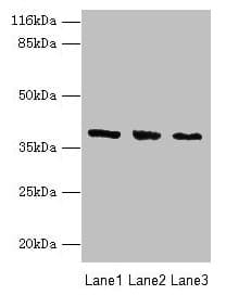 GALE / UDP-Glucose 4-Epimerase Antibody (aa1-348)