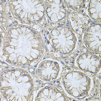 Polyclonal Rabbit anti-Human PTP4A3 Antibody (IHC, WB)