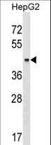 Polyclonal Rabbit anti-Human KRT23 / Keratin 23 Antibody (aa141-170, WB)