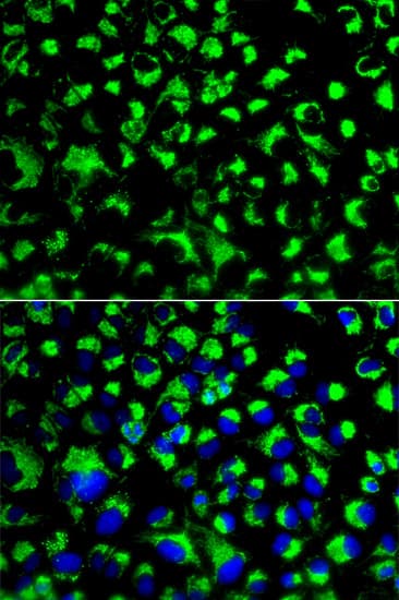 Polyclonal Rabbit anti-Human HSPA9 / Mortalin / GRP75 Antibody (IHC, IF, WB)