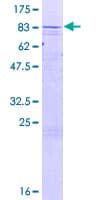 Human CYP4Z1 Protein (Recombinant GST)