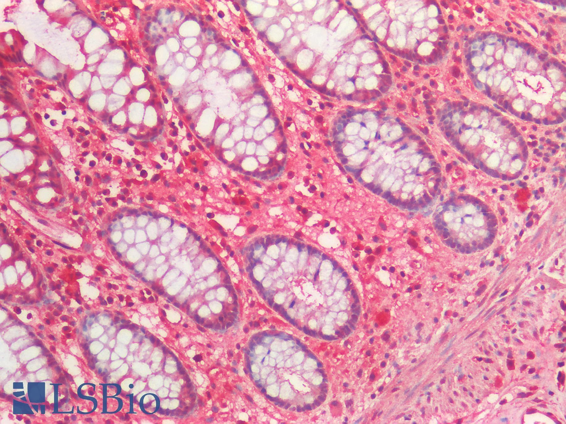 IHC-plus™ GFRA3 Antibody
