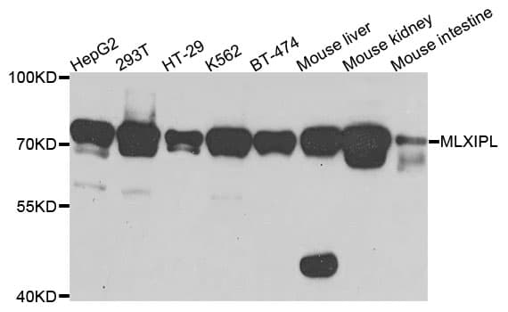 MLXIPL / CHREBP Antibody