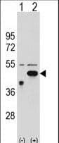 ETNK2 Antibody (aa58-87)
