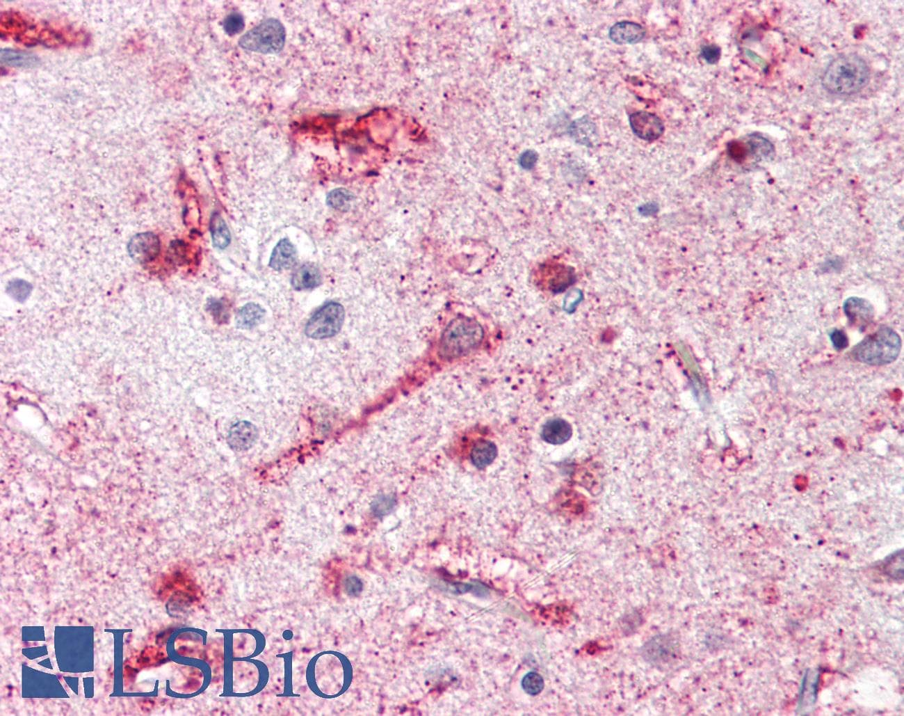 IHC-plus™ MC4R / Melanocortin 4 Receptor Antibody (Cytoplasmic Domain)