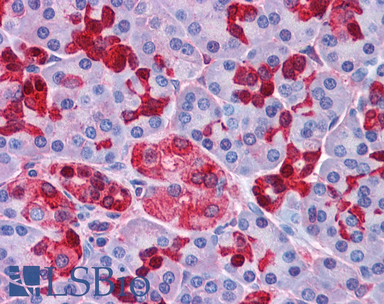 IHC-plus™ Polyclonal Rabbit anti-Human OTUD4 Antibody (IHC, IF, WB)