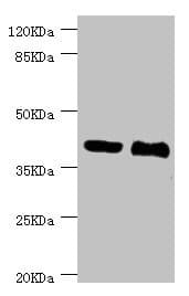 MALIN / NHLRC1 Antibody