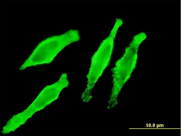 MYL2 Antibody (clone 3B9-B4)