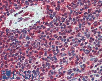 IHC-plus™ Monoclonal Mouse anti-Human TPI1 / TPI Antibody (IHC, WB)