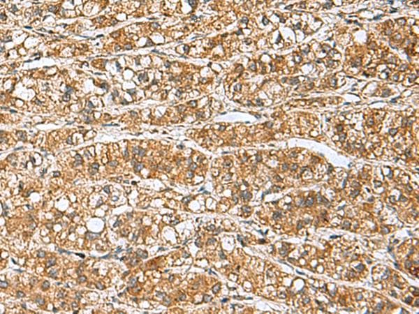GINS3 Antibody