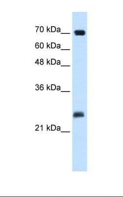 SERTAD1 / TRIP-Br1 / SEI-1 Antibody (N-Terminus)