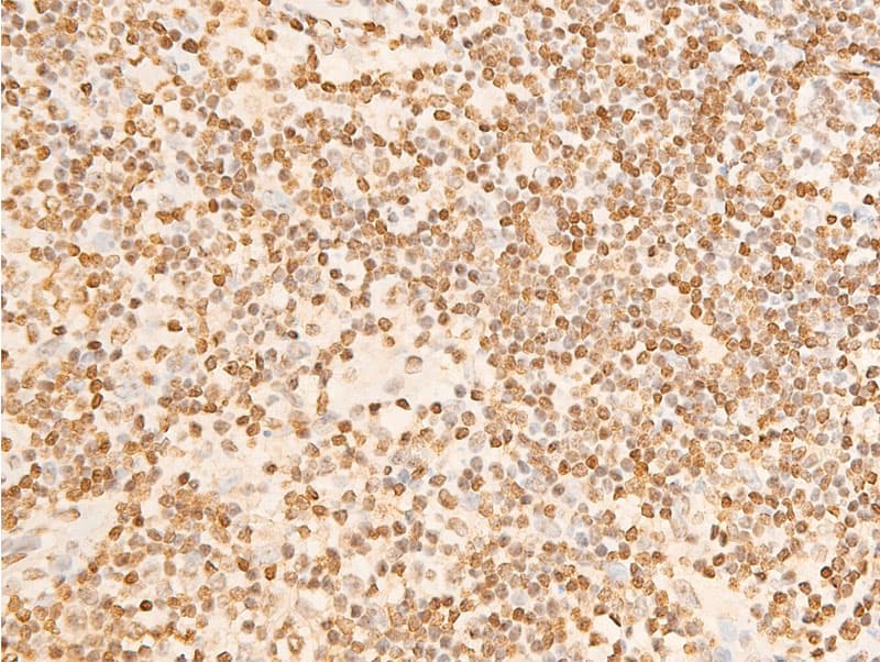 Polyclonal Rabbit anti-Human EIF2S1 Antibody (phospho-Ser51, IHC, IF, WB)