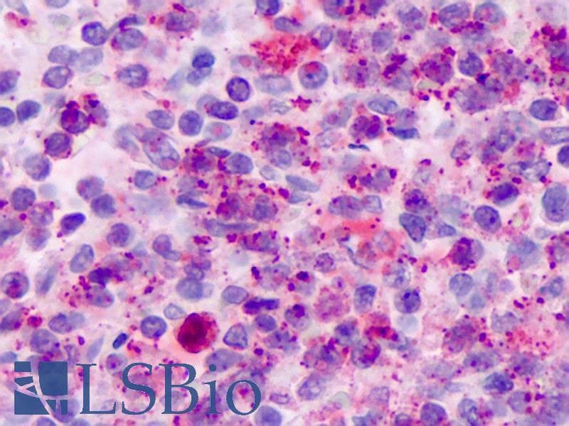 IHC-plus™ Polyclonal Rabbit anti-Human FPR2 / FPRL1 Antibody (N-Terminus, IHC)
