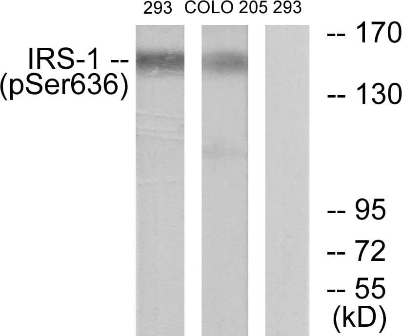 Polyclonal Rabbit anti-Human IRS1 Antibody (phospho-Ser636, IHC, IF, WB)